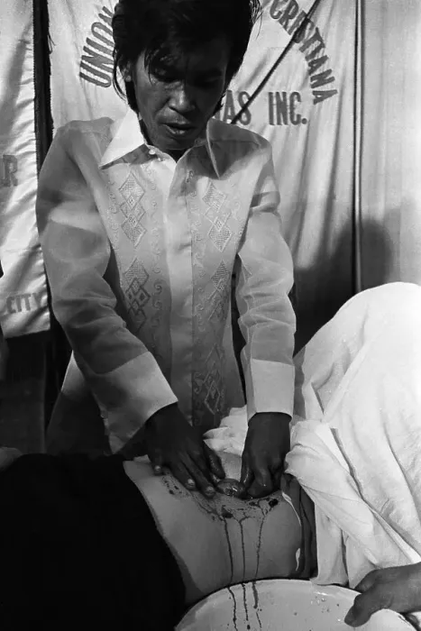 Framed Print : Alex Orbito Applies Pressure to Patient Framed Print : Alex Orbito Applies Pressure to Patient