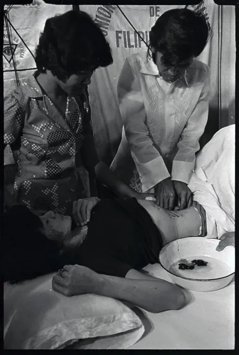 Framed Print : Alex Orbito is Shown Treating a Patient's Stomach Framed Print : Alex Orbito is Shown Treating a Patient's Stomach