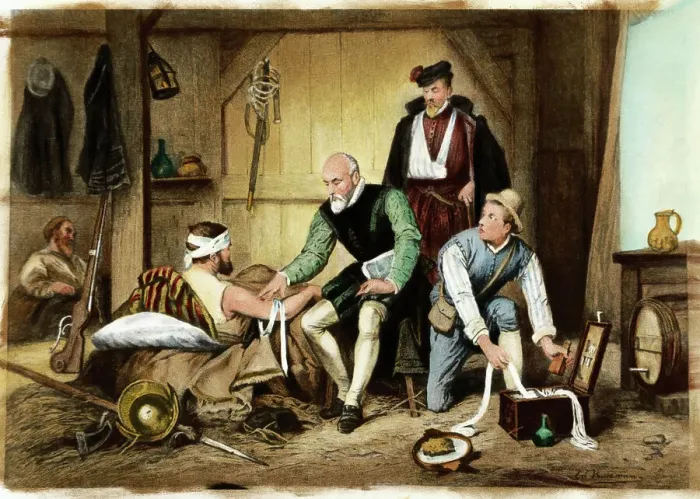 Framed Print : Ambroise Pare Treating Wounded Soldier Framed Print : Ambroise Pare Treating Wounded Soldier