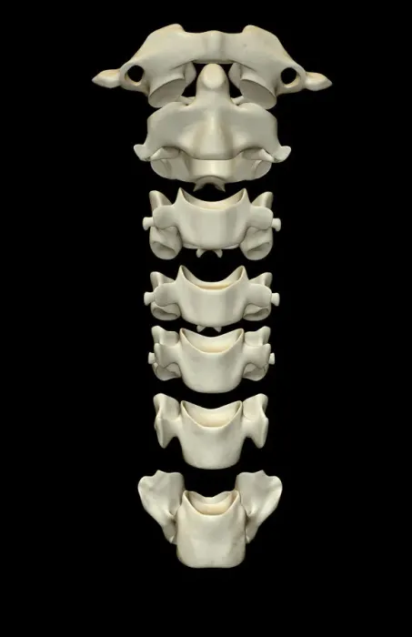 Framed Print : anatomy, atlas bone, axis bone, back bone, black background, bone, bone structure Framed Print : anatomy, atlas bone, axis bone, back bone, black background, bone, bone structure
