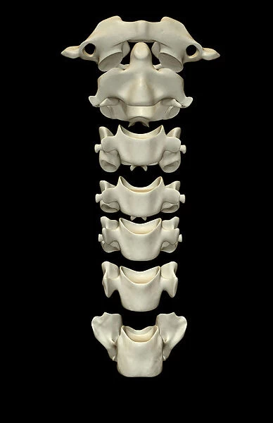 anatomy, atlas bone, axis bone, back bone, black background, bone, bone structure