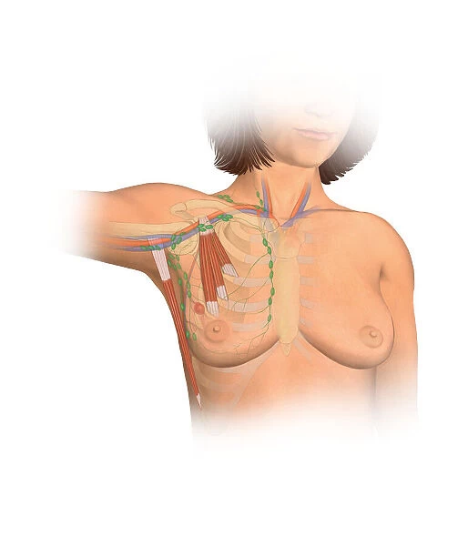 Anterior view female anatomy showing breast tissue with a tumor