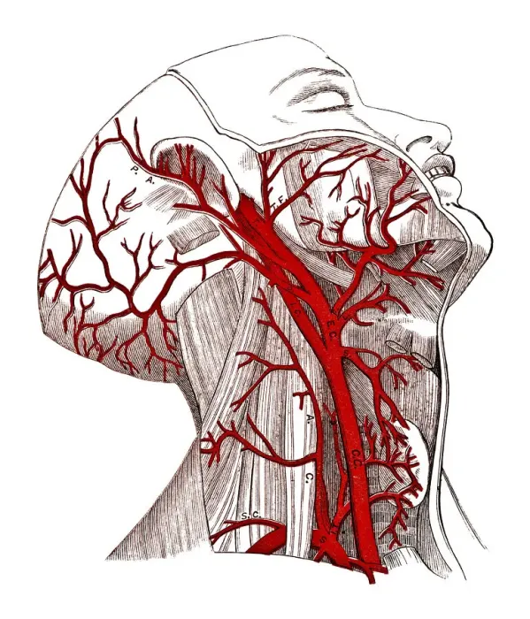 Framed Print : Arteries of The Head Framed Print : Arteries of The Head