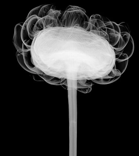 Artichoke (Cynara scolymus), X-ray
