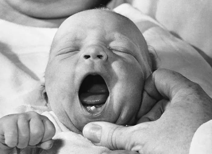 Framed Print : Baby With One Tooth / Lower Gum Framed Print : Baby With One Tooth / Lower Gum