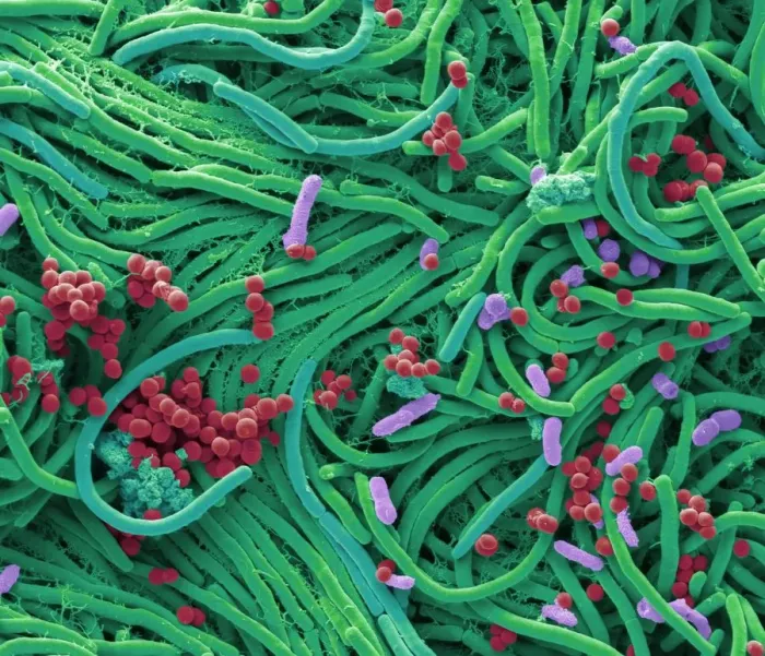 Framed Print : Bacteria found on mobile phone, SEM Framed Print : Bacteria found on mobile phone, SEM