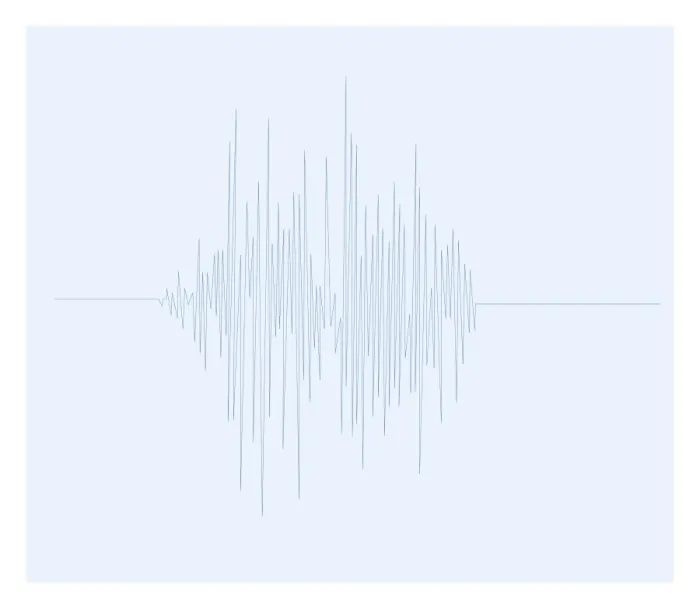 Framed Print : Biomedical illustration of Otoacoustic Emission sound wave chart