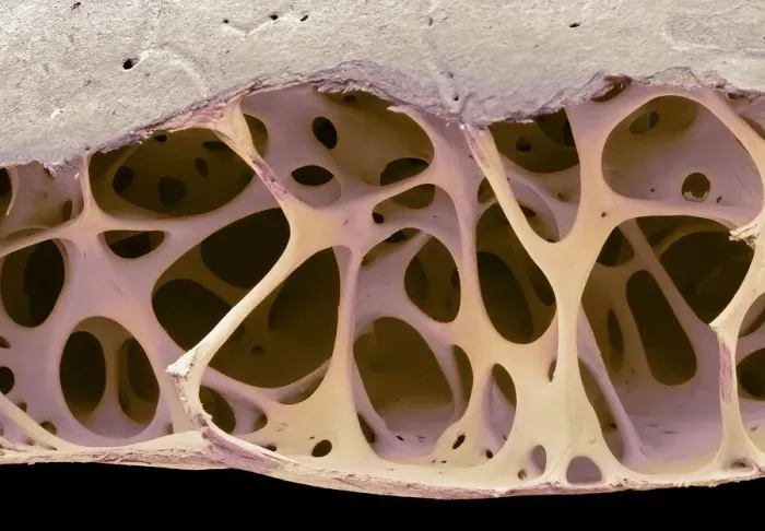 Framed Print : Bird bone tissue, SEM Framed Print : Bird bone tissue, SEM