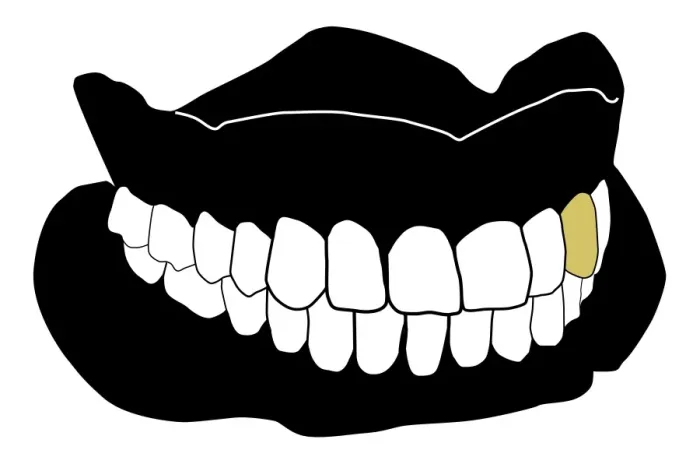 Framed Print : Black and white digital illustration of set of dentures with gold tooth amid white teeth Framed Print : Black and white digital illustration of set of dentures with gold tooth amid white teeth