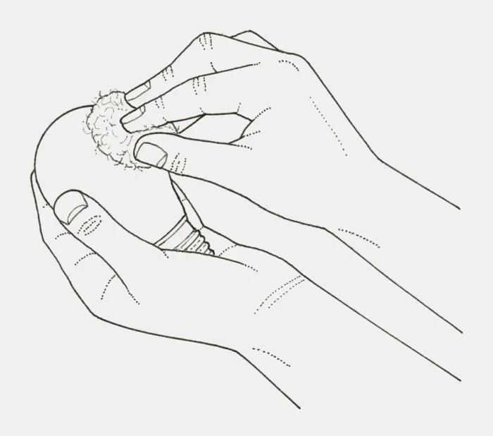 Framed Print : Black and white illustration of hands wiping a light bulb with cotton wool moistened with methylated spirit Framed Print : Black and white illustration of hands wiping a light bulb with cotton wool moistened with methylated spirit