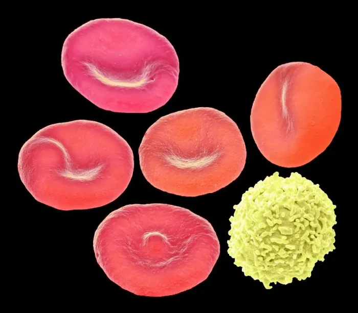 Framed Print : Blood cells, SEM Framed Print : Blood cells, SEM