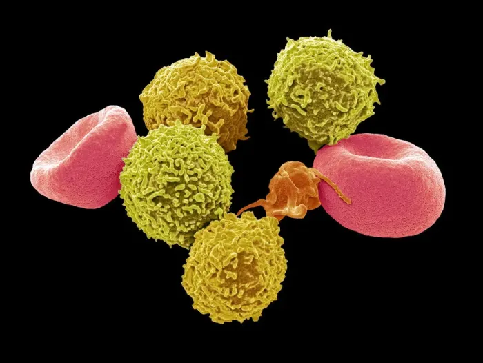 Framed Print : Blood cells, SEM Framed Print : Blood cells, SEM