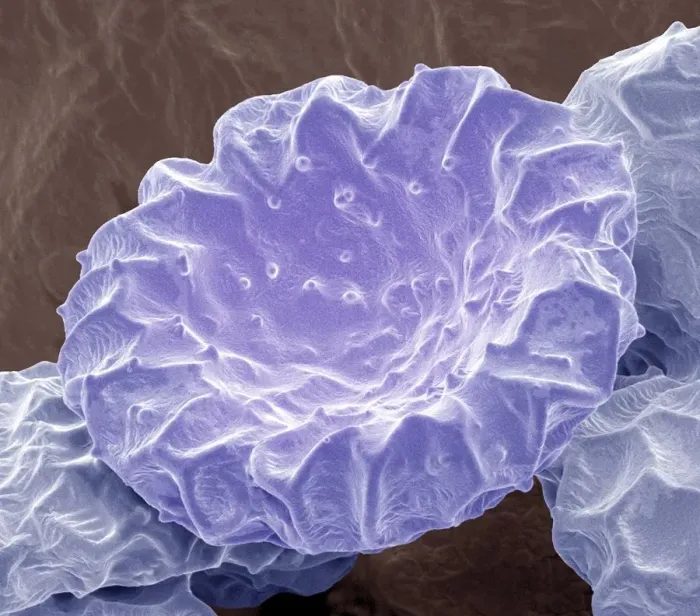 Framed Print : Bougainvillea pollen, SEM Framed Print : Bougainvillea pollen, SEM