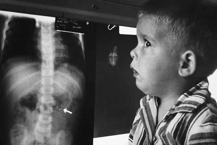 Framed Print : Brad Haines Looking at X-Ray of His Stomach Framed Print : Brad Haines Looking at X-Ray of His Stomach