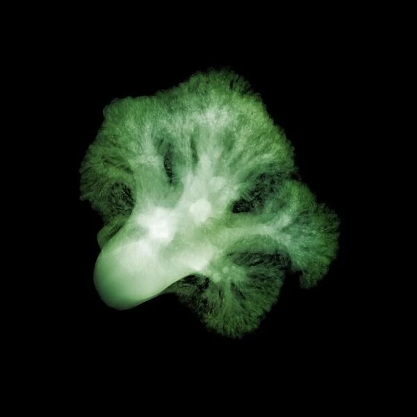 Broccoli (Brassica oleracea), X-ray