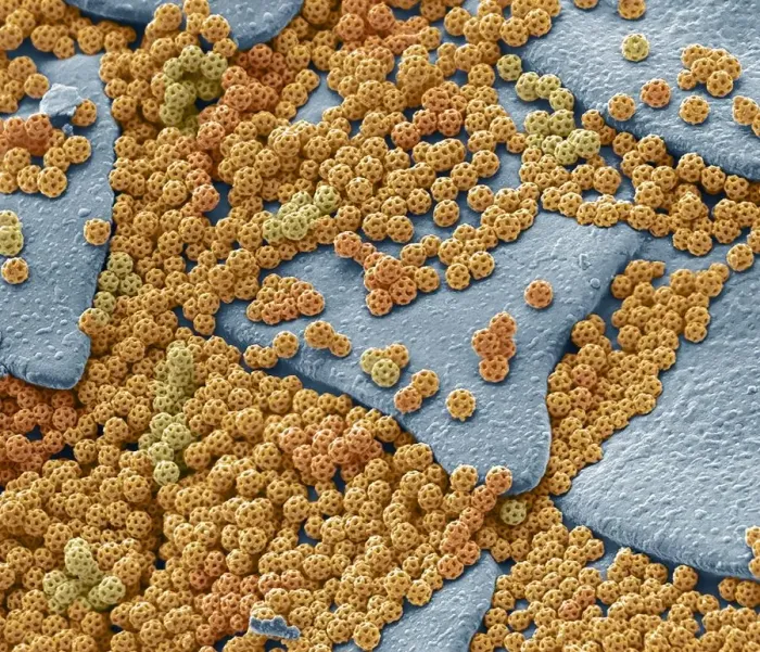 Framed Print : Brochosomes, SEM Framed Print : Brochosomes, SEM