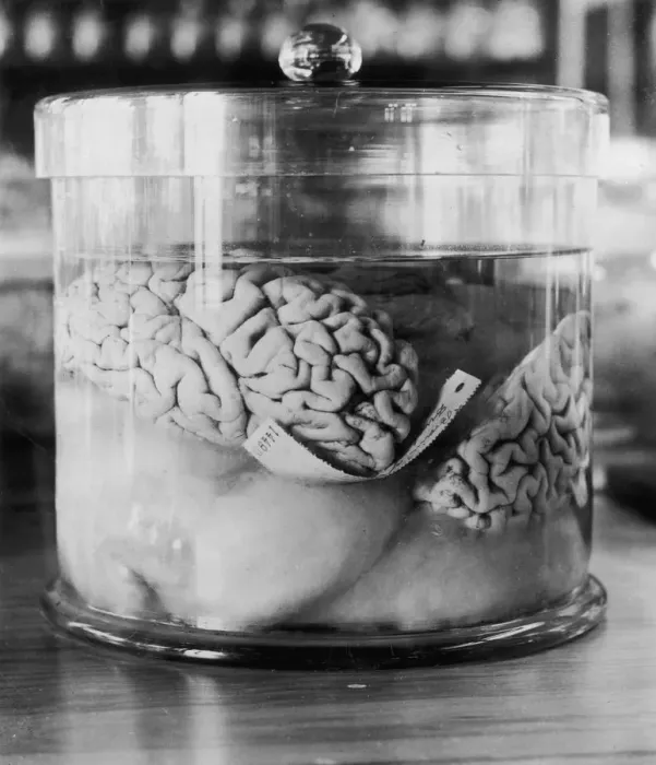 Framed Print : Burglars Brain Framed Print : Burglars Brain