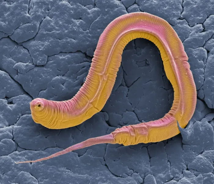 Framed Print : C elegans, SEM