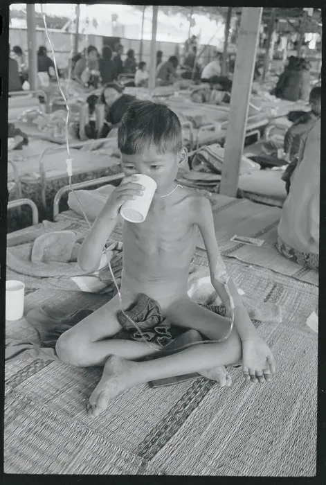 Framed Print : Cambodian Refugee Boy Drinking Medicine Framed Print : Cambodian Refugee Boy Drinking Medicine