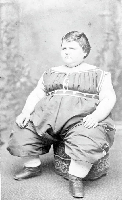 Framed Print : Carte de visite portrait of '300 Pound Girl' from Circus Sideshow, Carrie Akers, circa 1870s