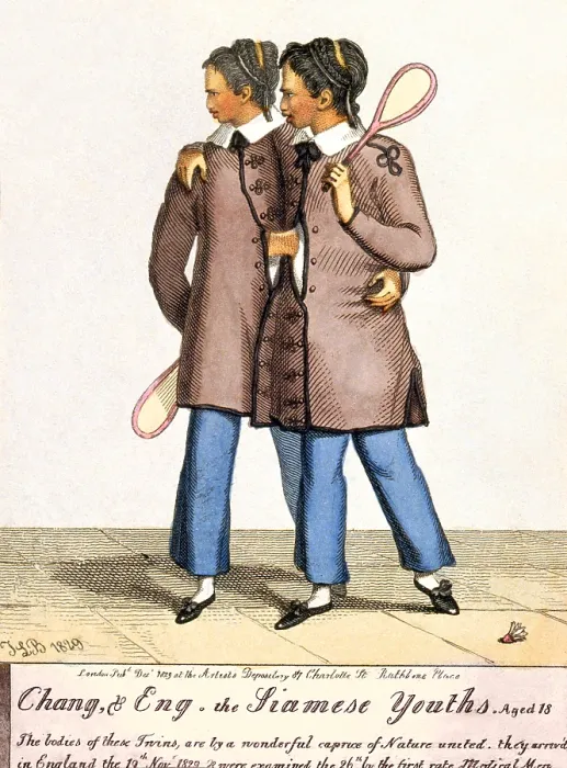 Framed Print : Chang, & Eng. the Siamese Youths. Aged 18 Framed Print : Chang, & Eng. the Siamese Youths. Aged 18