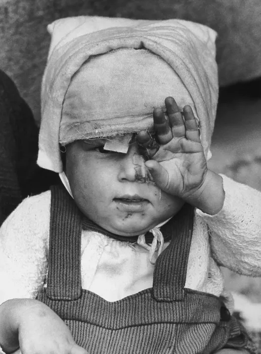 Framed Print : Child Refugee