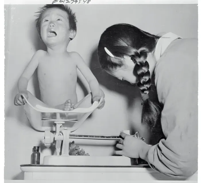 Framed Print : Child Being Weighed on Scale Framed Print : Child Being Weighed on Scale