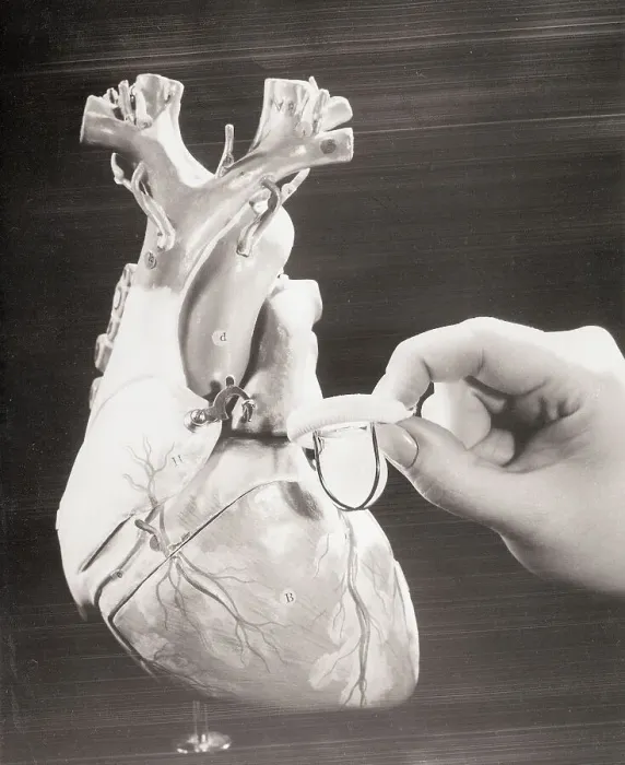 Framed Print : Close-Up of Artificial Heart Valve Framed Print : Close-Up of Artificial Heart Valve