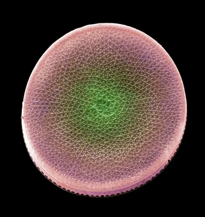 Framed Print : Colored scanning electron micrograph(SEM) Framed Print : Colored scanning electron micrograph(SEM)