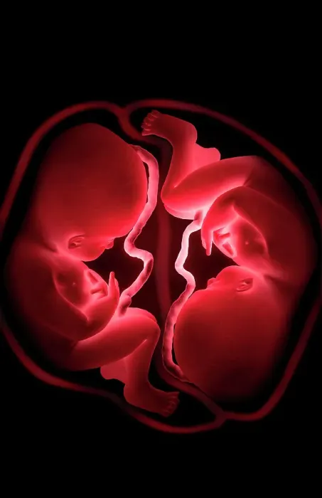 Framed Print : Twins. A conceptual image depicting a womb containing stylized twin fetus Framed Print : Twins. A conceptual image depicting a womb containing stylized twin fetus