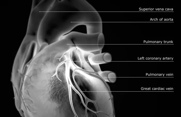 Framed Print : The coronary vessels of the heart Framed Print : The coronary vessels of the heart