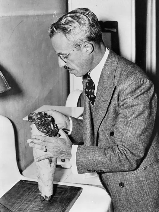 Framed Print : Coroner Examining a Dissected Leg