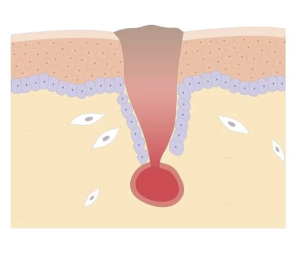 Cross section biomedical illustration of blood clotting over broken skin and fibroblasts multiplying and migrating to injury