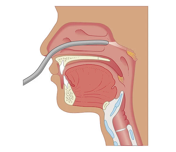 Cross section biomedical illustration of endoscopy of the nose and throat