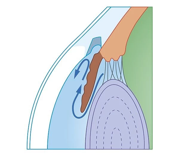 Cross section biomedical illustration of fluid flow in chronic glaucoma