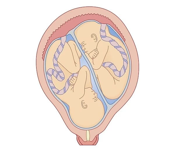Cross section biomedical illustration of identical twins in uterus sharing placenta