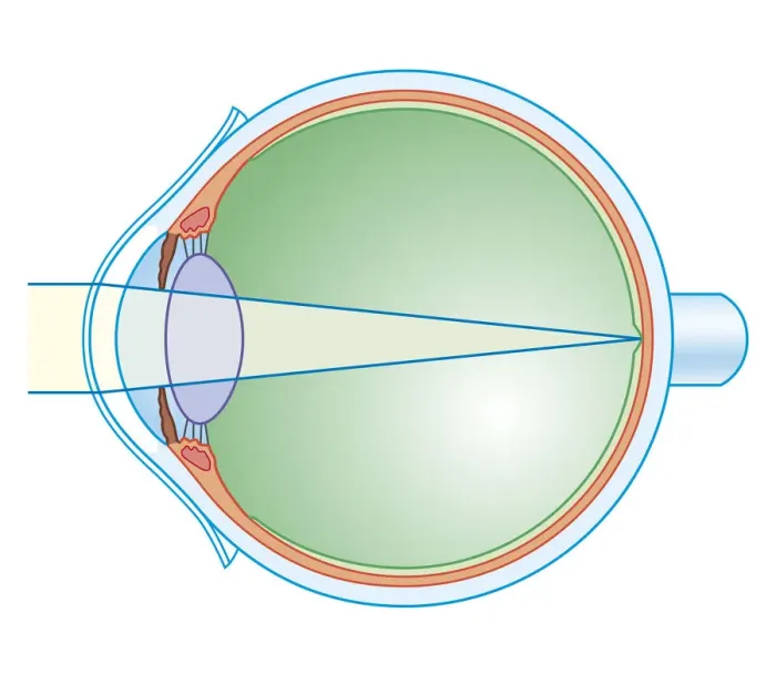 Framed Print : Cross section biomedical illustration of key anatomy of the eye