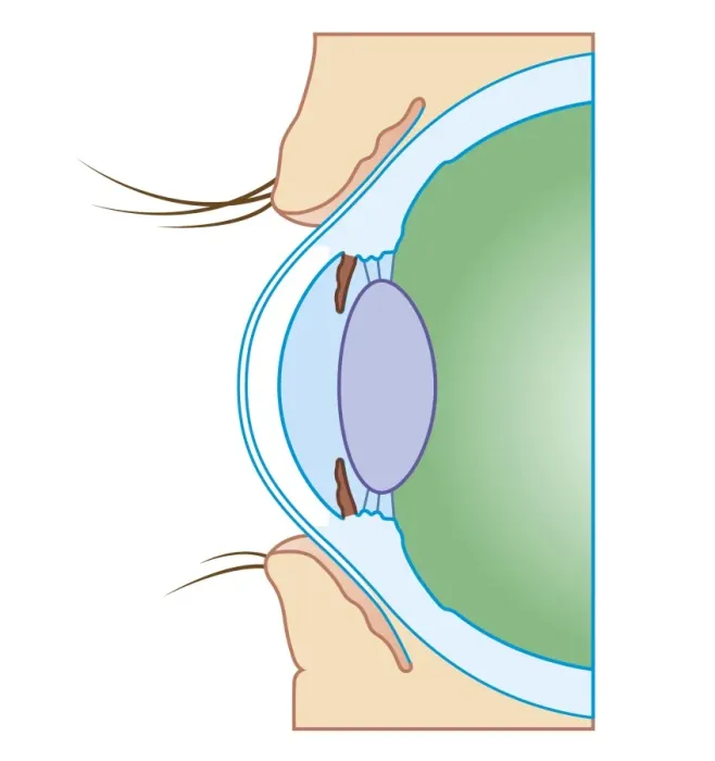 Framed Print : Cross section biomedical illustration of normal eye