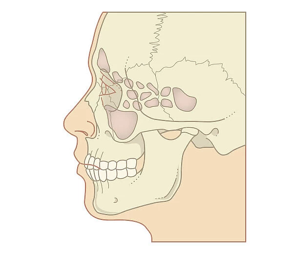 Cross section biomedical illustration of position of sinuses, profile