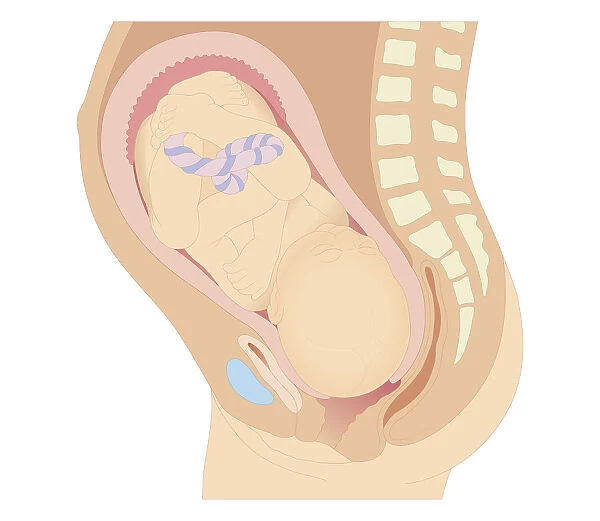 Cross section biomedical illustration of position of foetus in uterous prior to birth