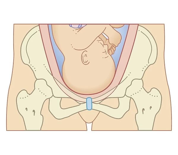 Cross section biomedical illustration of position of head of foetus before engagement process