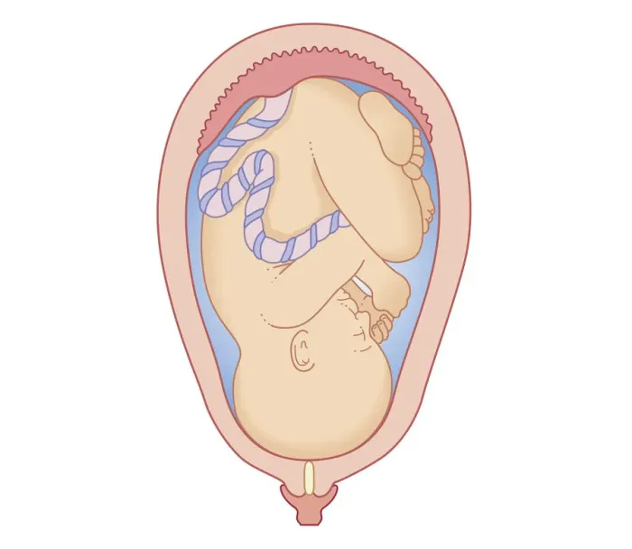 Framed Print : Cross section biomedical illustration of position foetus at first stage of labour Framed Print : Cross section biomedical illustration of position foetus at first stage of labour