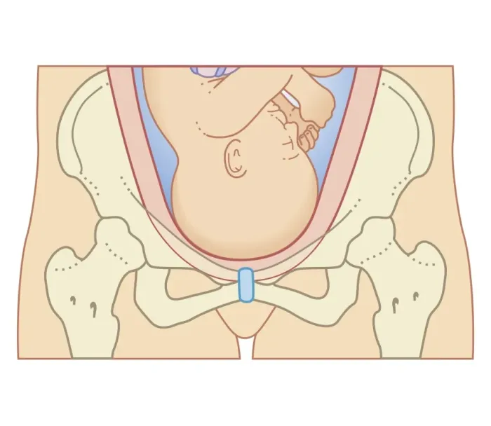 Framed Print : Cross section biomedical illustration of position of head of foetus before engagement process Framed Print : Cross section biomedical illustration of position of head of foetus before engagement process