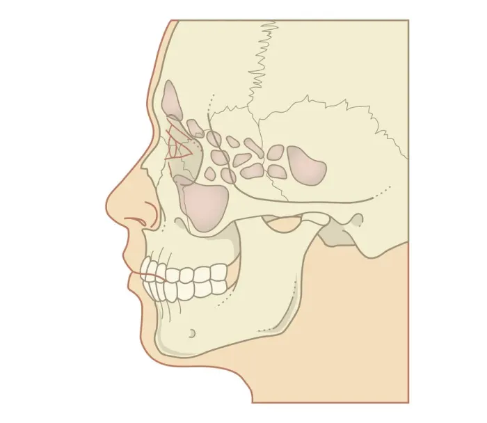 Framed Print : Cross section biomedical illustration of position of sinuses, profile Framed Print : Cross section biomedical illustration of position of sinuses, profile