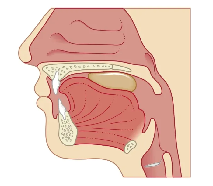 Framed Print : Cross section biomedical illustration of position of soft palate and epiglottis during swallowing Framed Print : Cross section biomedical illustration of position of soft palate and epiglottis during swallowing