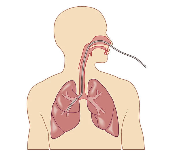 Cross section biomedical illustration of route of bronchoscope inserted through nose