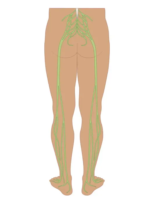 Framed Print : Cross section biomedical illustration of sciatic nerves beginning at the lower back, through buttocks down to lower limbs