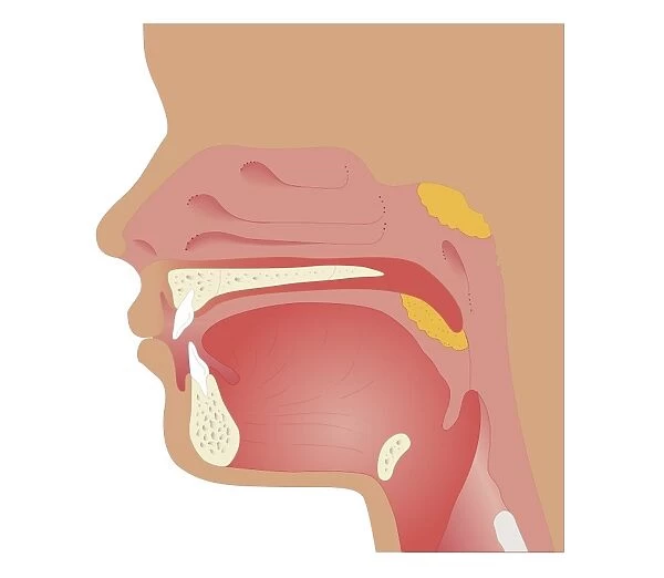 Cross section biomedical illustration of sites of tonsilectomy and adenoidectomy procedures