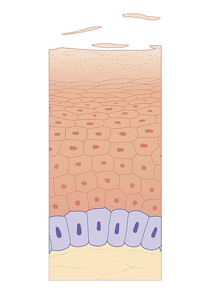 Cross section biomedical illustration of skin growth showing four layers of epidermis