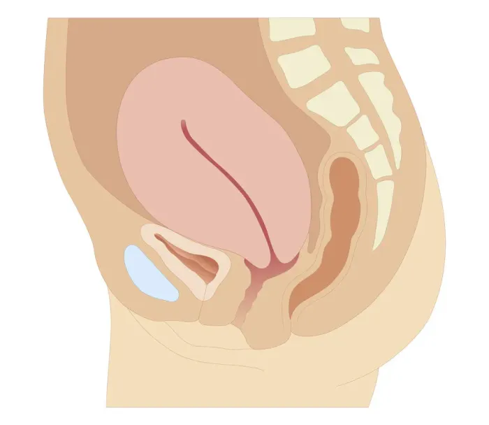 Framed Print : Cross section biomedical illustration of uterus after giving birth Framed Print : Cross section biomedical illustration of uterus after giving birth